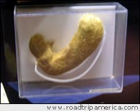 Giant bezoar