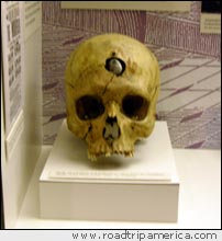 Skull with bullet wound
